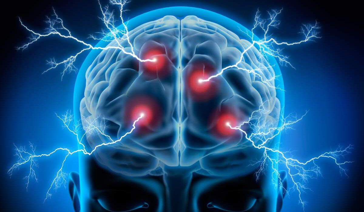 CEREBRO