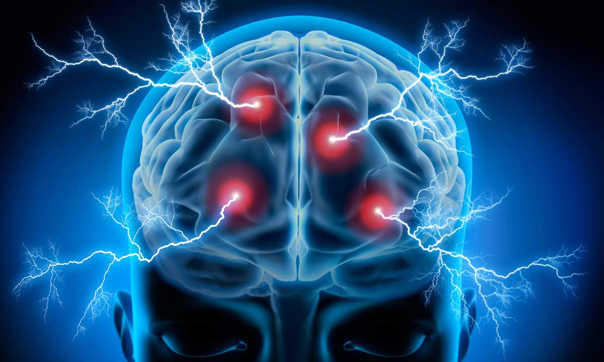 CEREBRO